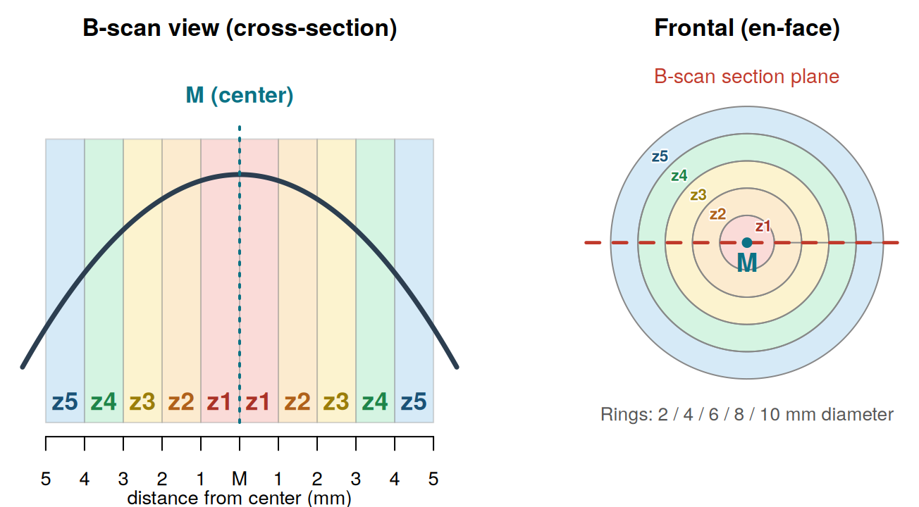 Zone diagram: B-scan cross-section view and frontal (en-face) view